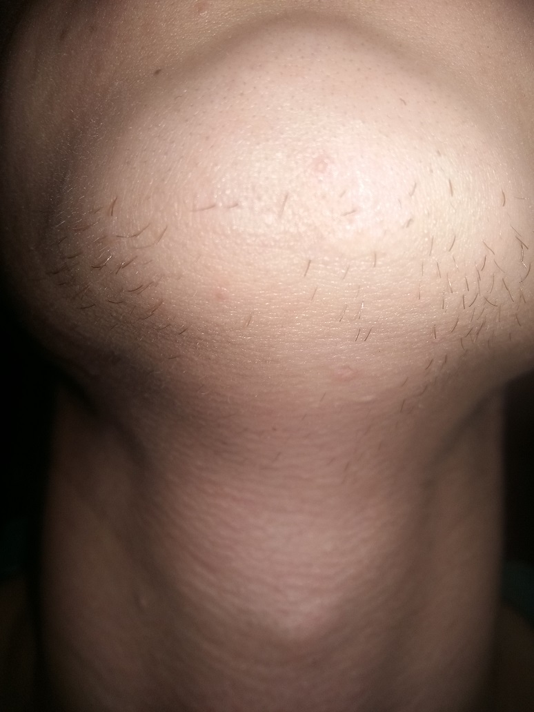 20160122_205646.jpg