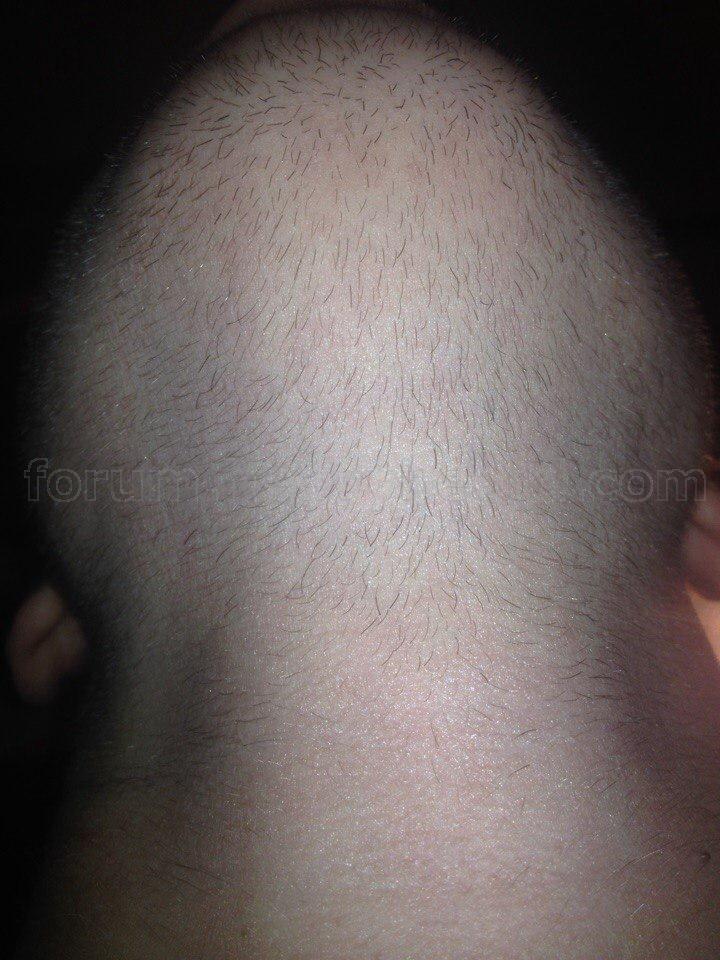 beard0.jpg