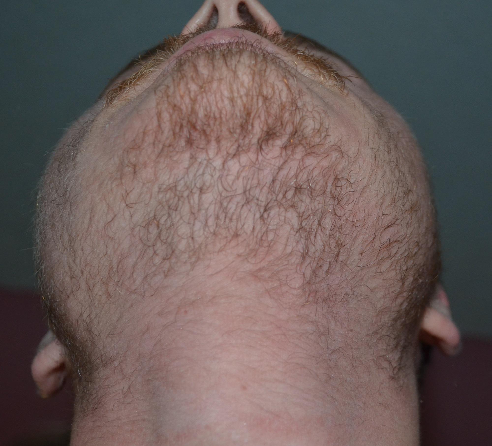35.jpg