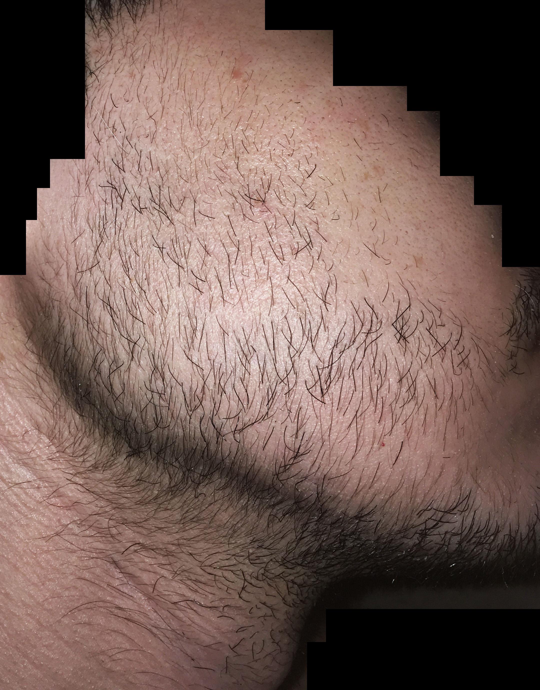 3.5m.jpg