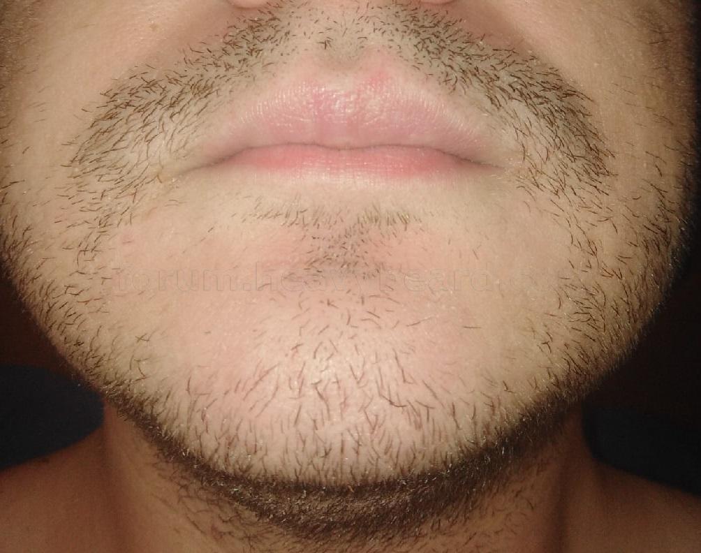555