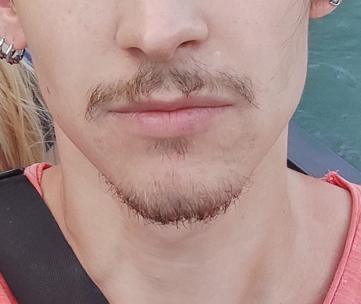 minox_before.jpg