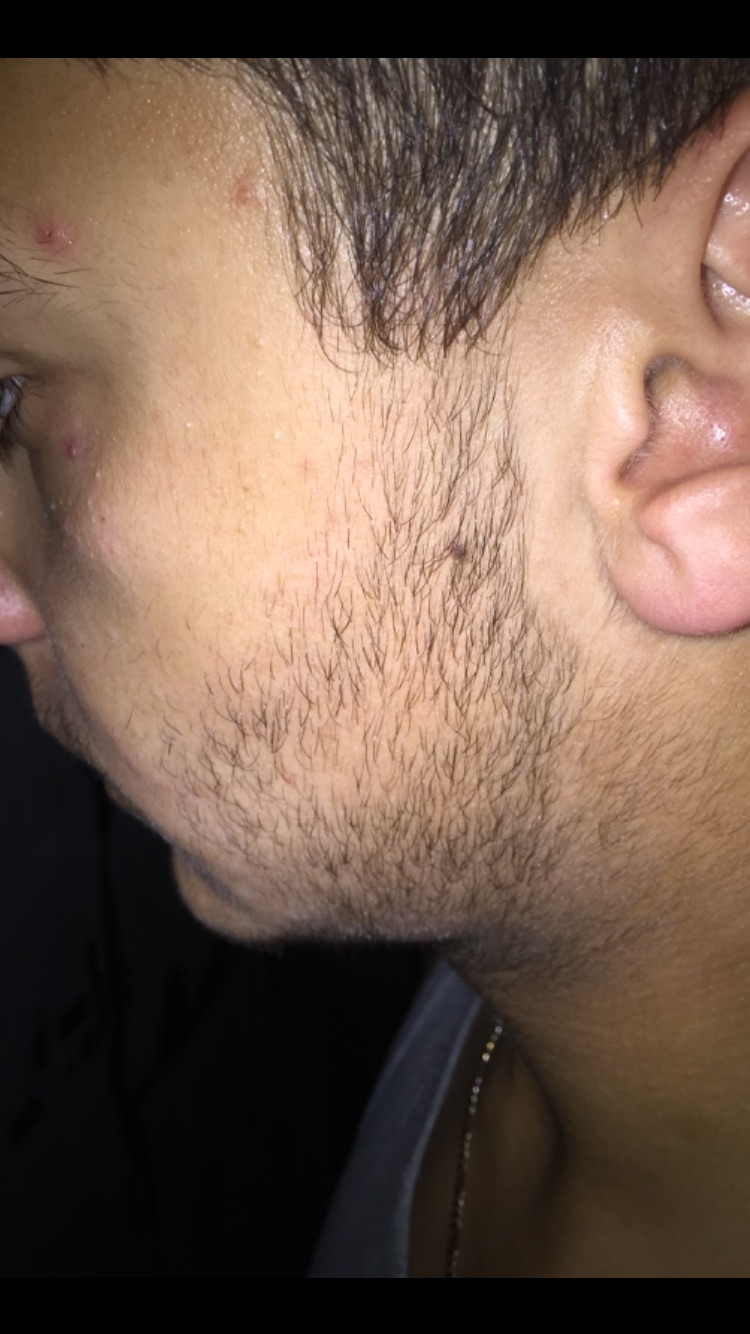 image.jpg