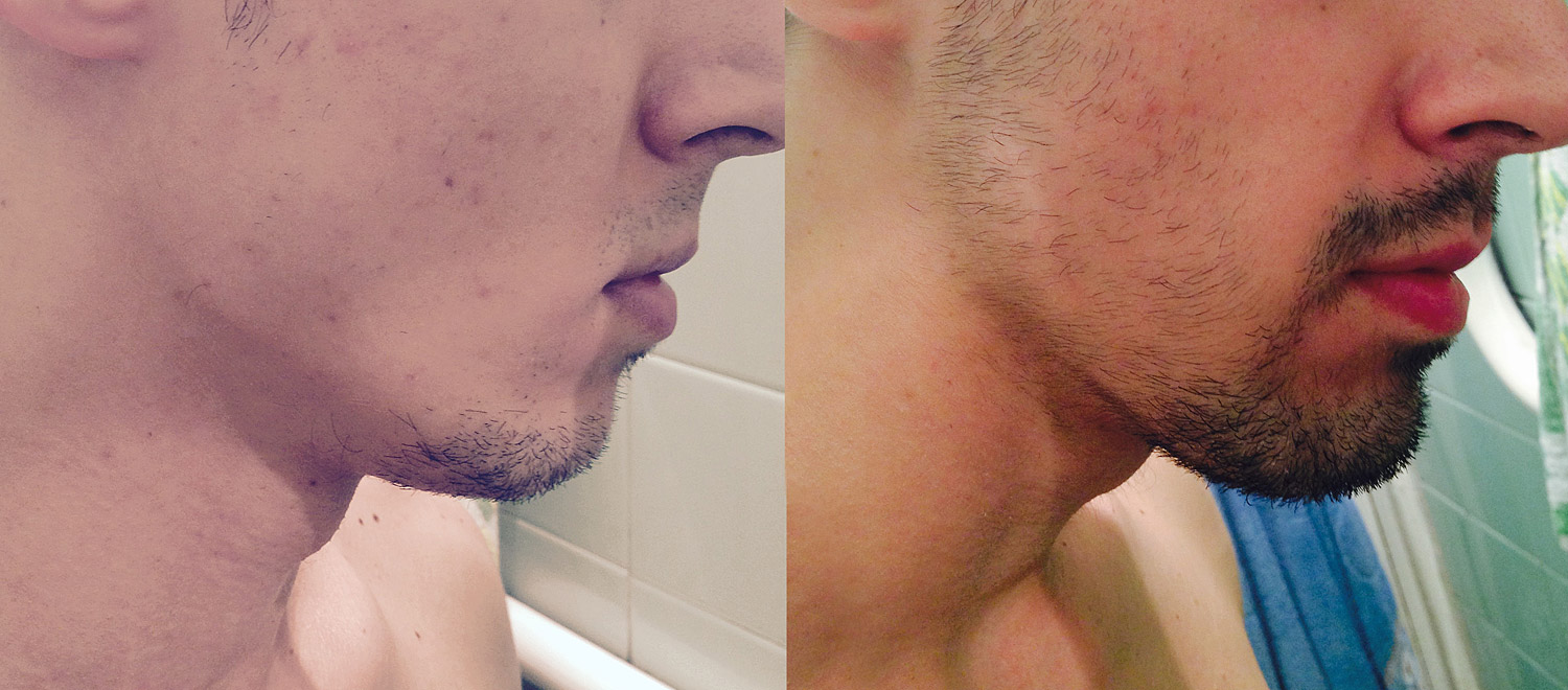 before_after.jpg