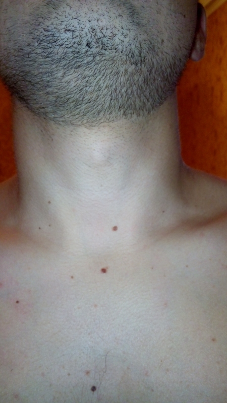 rps20150902_185910.jpg