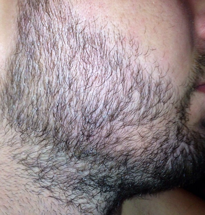 image.jpg
