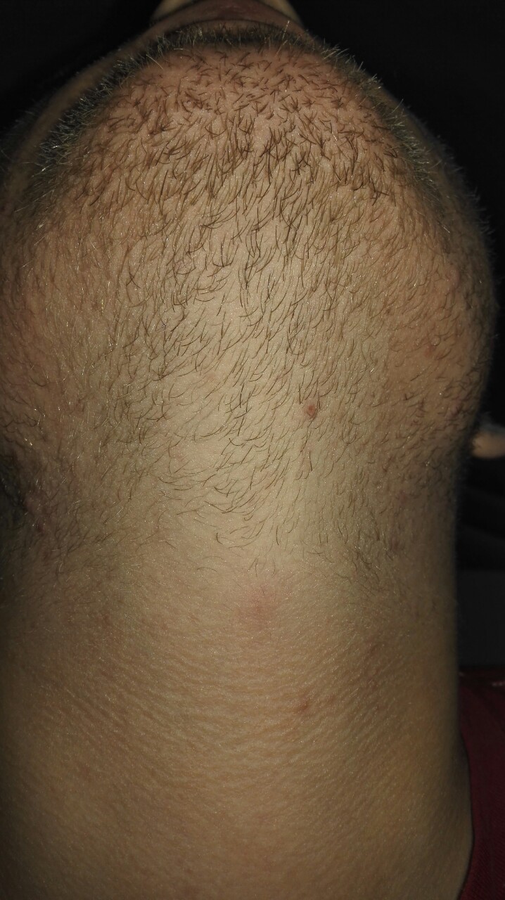 rps20160103_023318.jpg